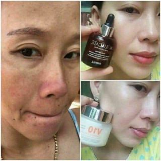 KEM V10 SKINAZ HÀN QUỐC
