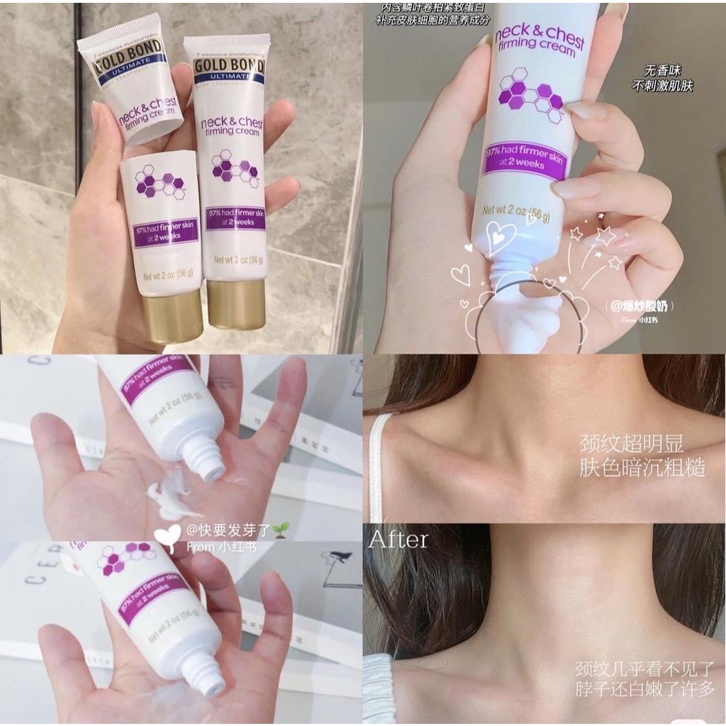 Kem dưỡng cổ và ngực Gold Bond Ultimate Neck And Chest Firming Cream