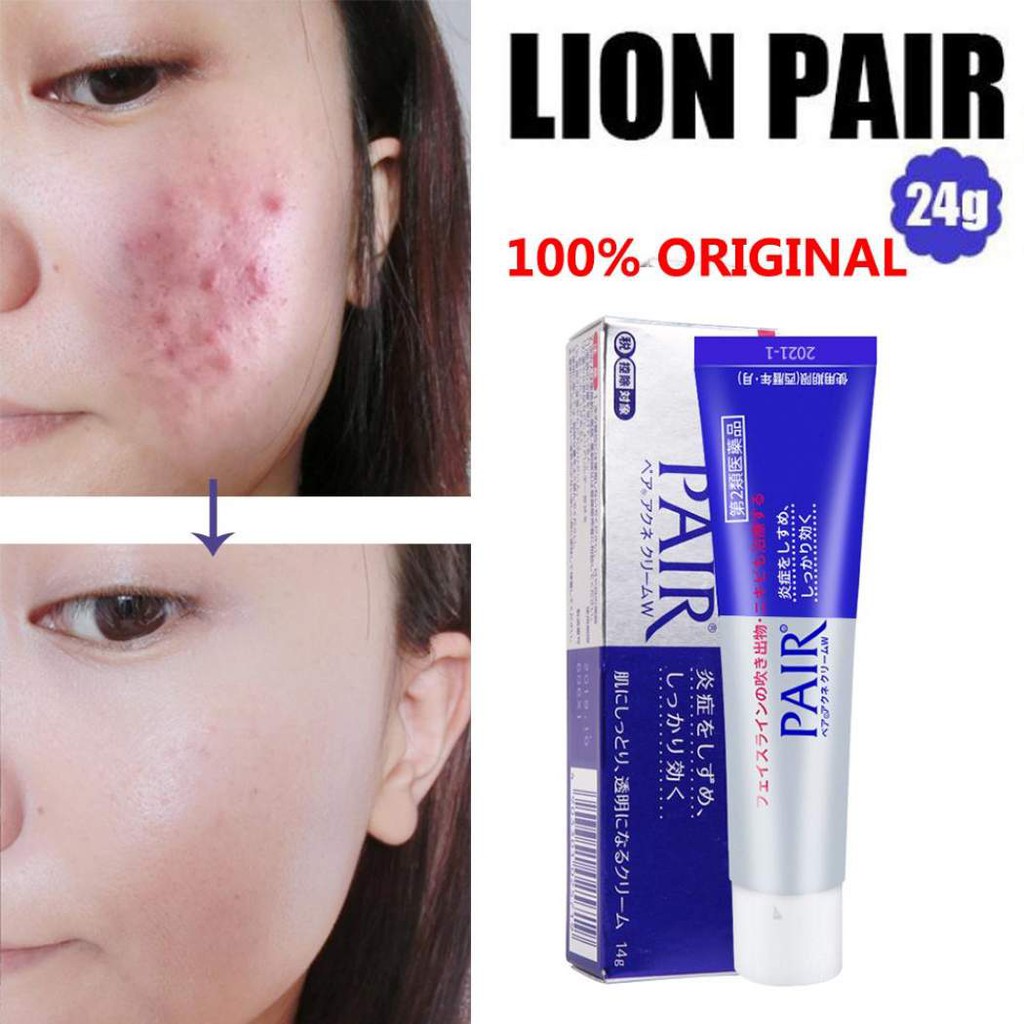 Kem hỗ trợ hết mụn Pair Acne W Cream Nhật Bản 24gr