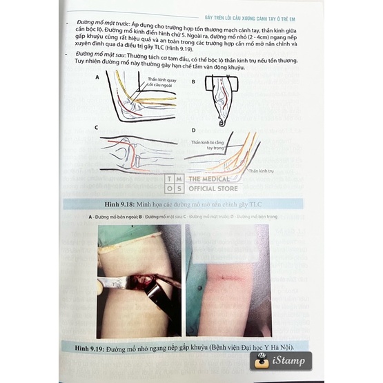 Sách - Chẩn Đoán Và Điều Trị Gãy Xương Trật Khớp Chi Trên Chi Dưới Tmos