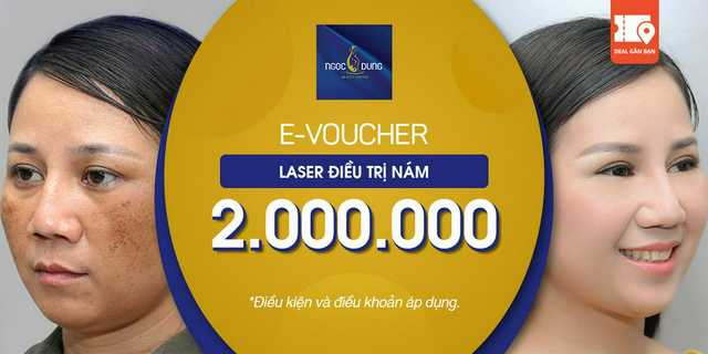 E-Voucher Laser điều trị Nám tại TMV Ngọc Dung