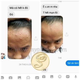 KEM NGỪA MỤN S2B BEAUTY