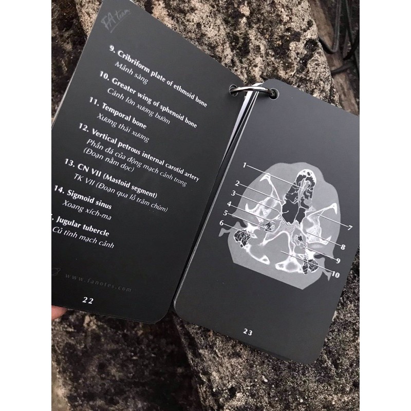 FA Xquang Head and Neck