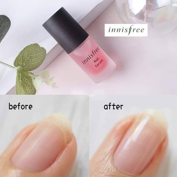 Dưỡng móng tay Innisfree Nail Serum 6ml - NiNiShop