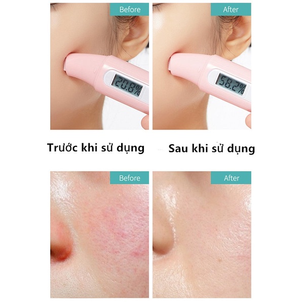 Sữa rửa mặt cấp nước BIOAQUA Dưỡng ẩm nhẹ nhàng, Làm sạch da mặt và Mụn đầu đen 60 G