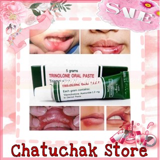 |Chính Hãng| KEM TRỊ NHIỆT MIỆNG TRINOLONE THÁI LAN ★