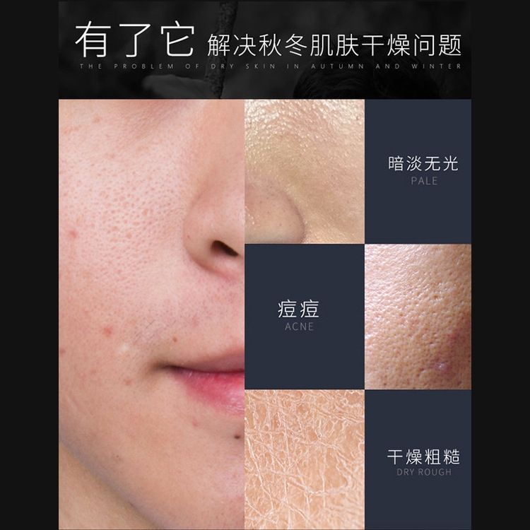 (hàng Mới Về) Gel Dưỡng Da Mặt Kiềm Dầu Cho Nam Giới Bt-jos | BigBuy360 - bigbuy360.vn