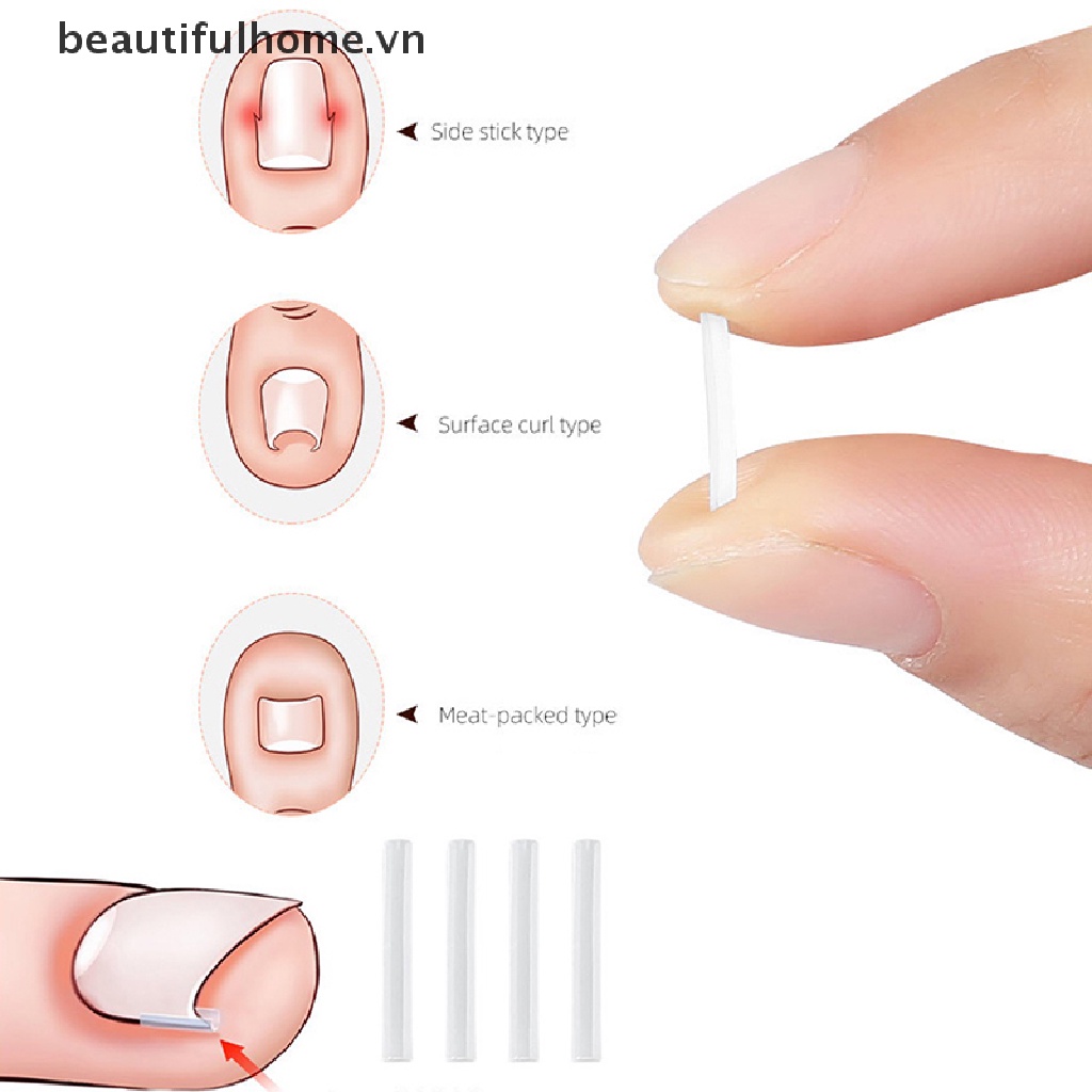 Bộ 10 Dụng Cụ Kích Thích Mọc Móng Lưng Tiện Dụng