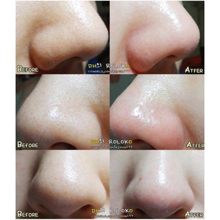 Mặt nạ hút mụn Goodbye Blackhead Ciracle