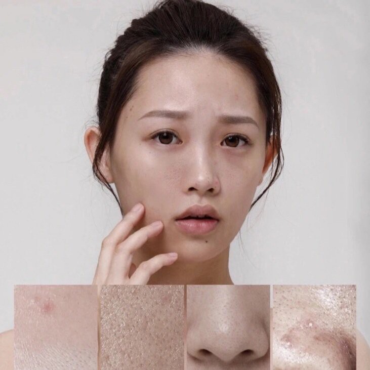 Toner Lactose Acid LUCENBASE nước hoa hồng se lỗ chân lông mịn da LACTOSE ACID PORE EXTRA-FIRMING TONER 120ml LUCB53 | BigBuy360 - bigbuy360.vn