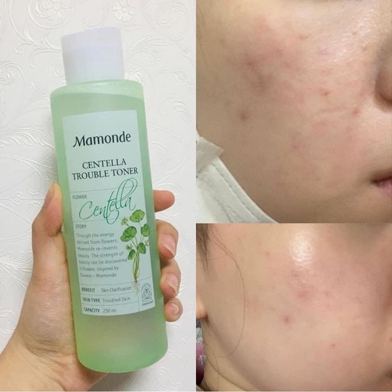 Toner Cân Bằng Da Mamonde Phiên Bản Mới Nhất