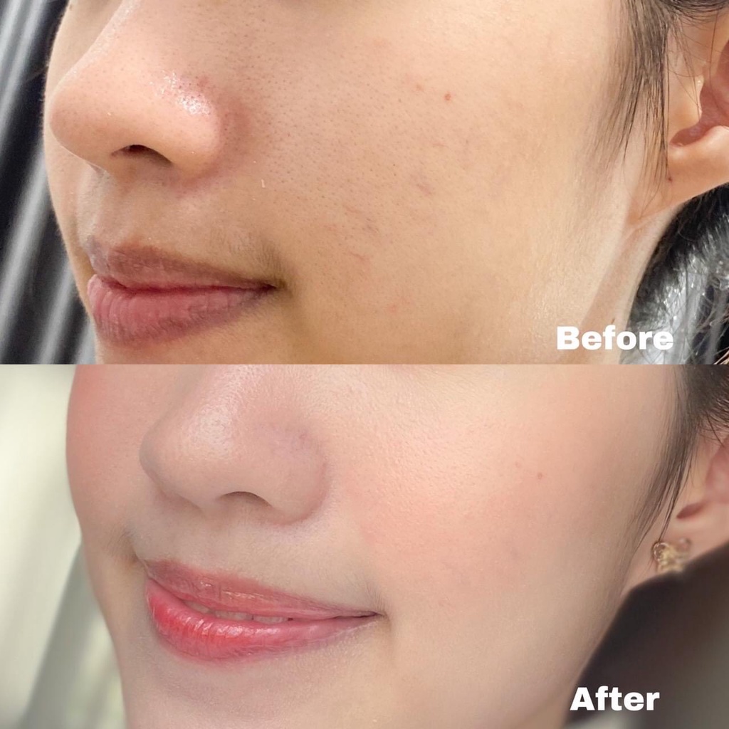 Phấn phủ dưỡng ẩm Butae Moisturising Powder Plus Butae C&amp;E kết cấu mỏng nhẹ thoải mái trên da 11g - Thái Lan