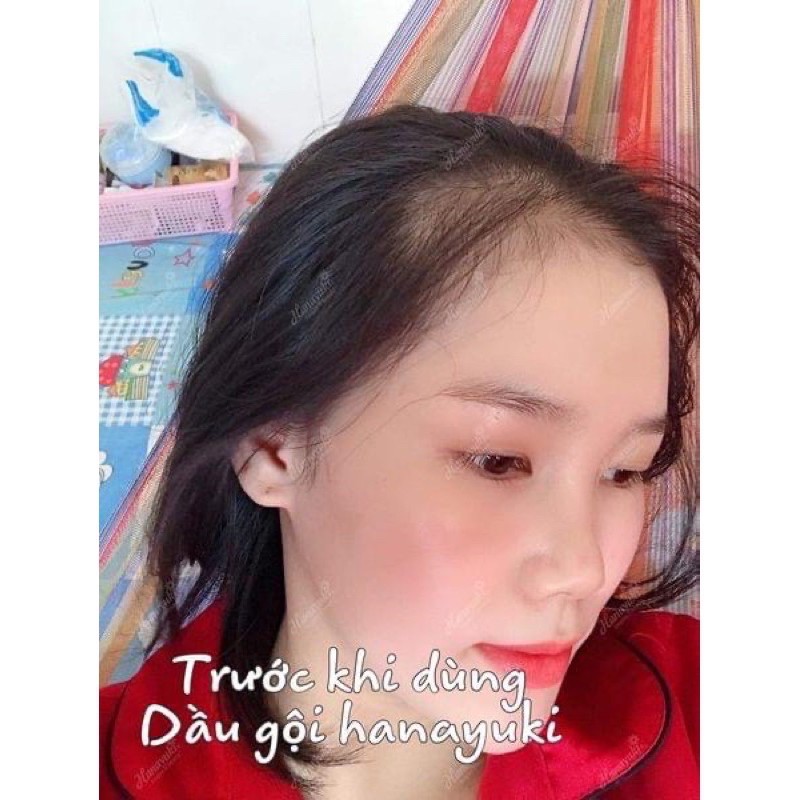 [CHÍNH HÃNG 100%] DẦU GỘI HANAYUKI BỒ KẾT giúp tóc giảm rụng, chắc khoẻ, sạch gàu nấm | BigBuy360 - bigbuy360.vn