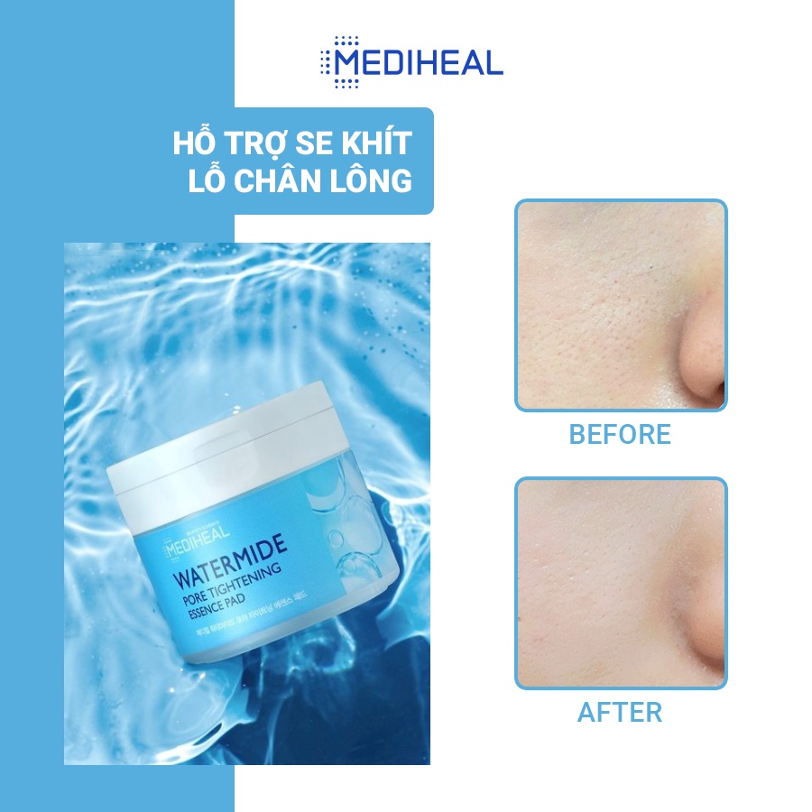 Hộp miếng đắp dưỡng ẩm và se khít lỗ chân lông Mediheal Watermide Pore Tightening Essence Pad 130ml (50 miếng)