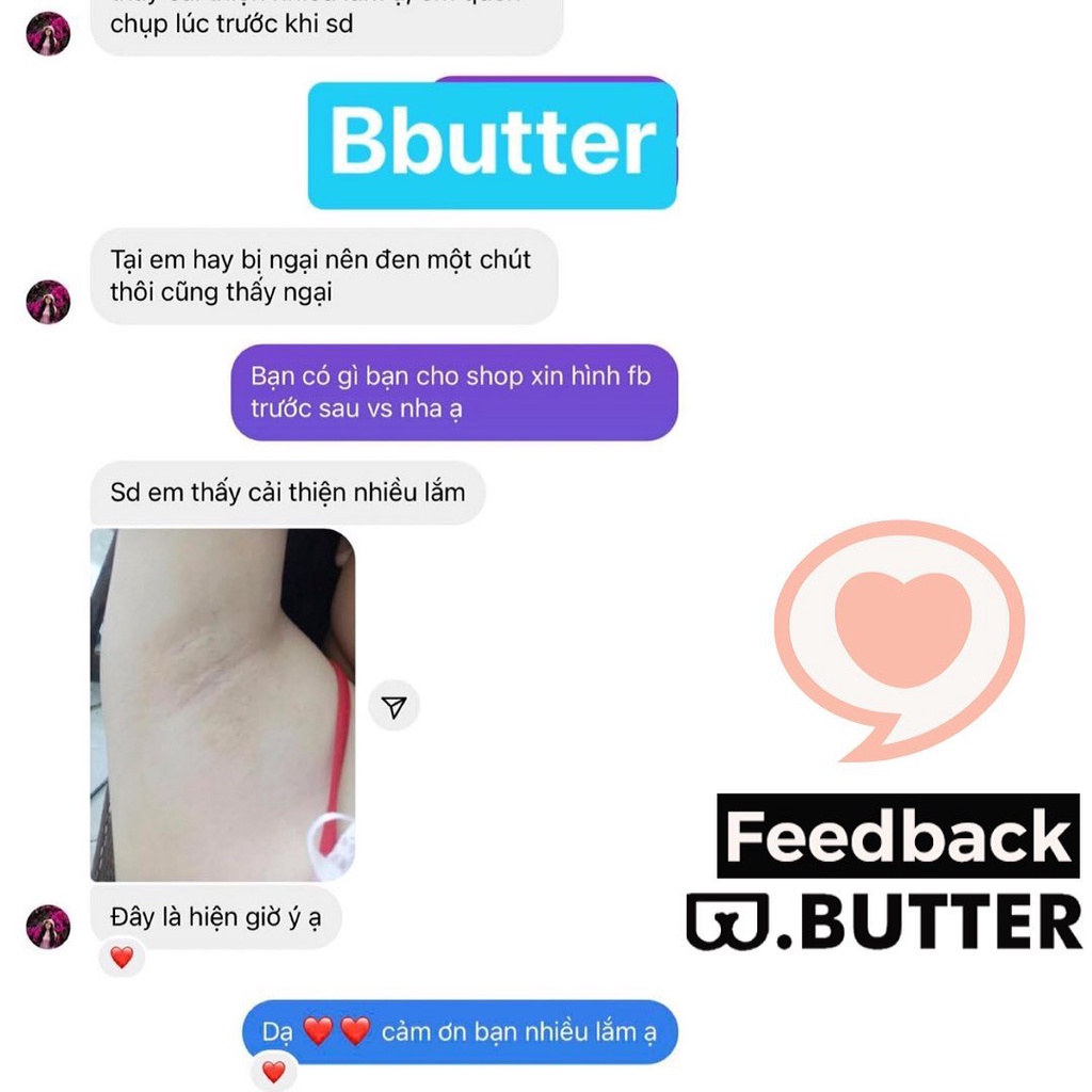 Mặt nạ Giảm mụn, Mờ thâm, sần cho vòng 3, nách - B.butter Body Mask