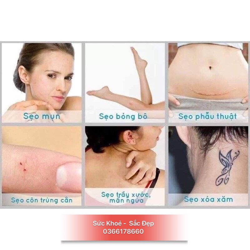 Kem loại bỏ sẹo Nga Klirvin - Kem sẹo Nga