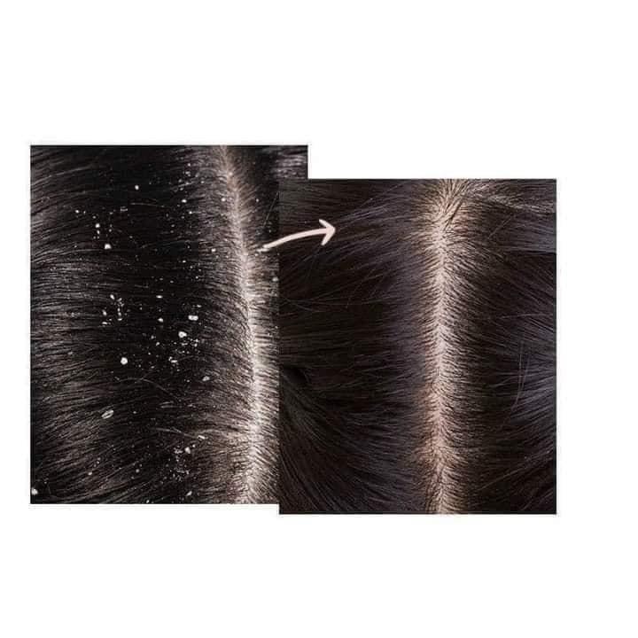 Tẩy Da Chết Da Đầu Cafe Mimi 330g_Hút Dầu Chống Bết Suốt 3 Ngày