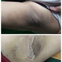 Lột trắng toàn thân NN ra mảng to