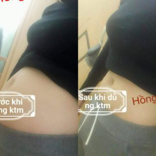Kem tan mỡ đánh tan mỡ bụng, đùi, bắp