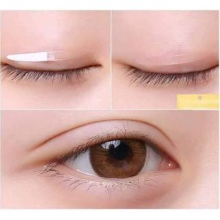 Miếng rán kích mí mắt 1 mí thành 2 mí