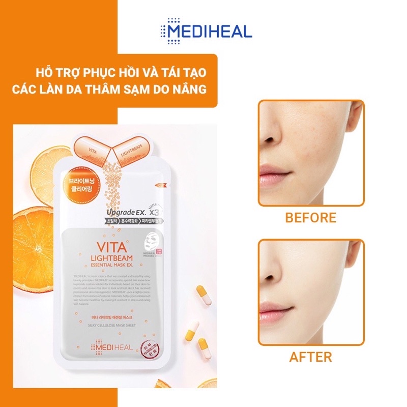 Mặt Nạ Dưỡng Trắng, Mờ Vết Thâm Mediheal Vita Lightbeam Essential Mask Ex 25ml - VITA