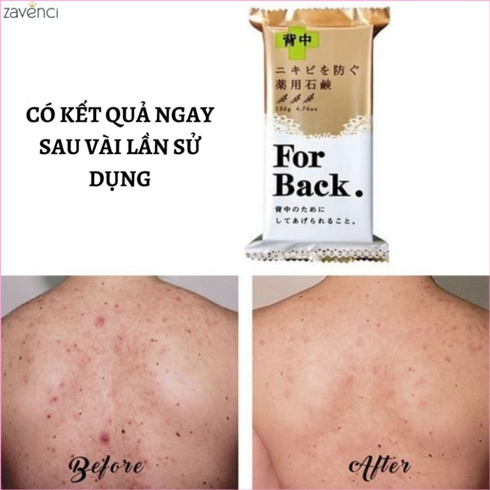 Xà Phòng FOR BACK Pelican Medicated Soap Làm Sạch Mụn Lưng Chiết Xuất Than Hoạt Tính Và Bùn Khoảng (135g)