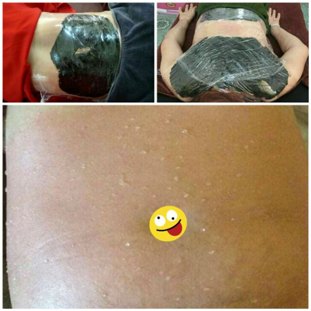 BÙN CỨU GIẢM BÉO - THƯ GIÃN, GIẢM ĐAU XƯƠNG KHỚP