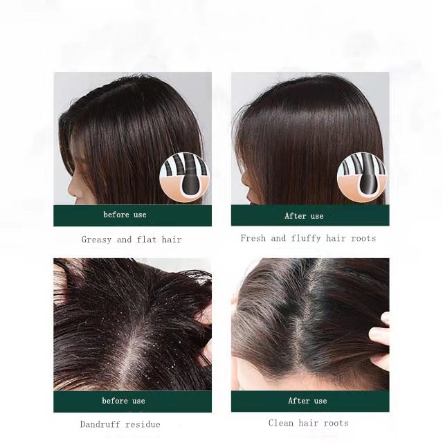 Set dầu gội và muối biến tẩy tế bào chết Gdtima chăm sóc sức khỏe tiện dụng