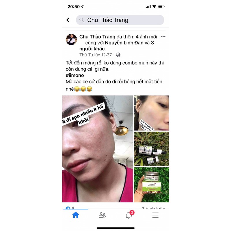 Serum tri mun Combo 2 hộp tinh chất mụn IIMONO 20ml tinh chat tri mun | BigBuy360 - bigbuy360.vn