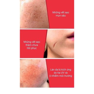 Serum Ốc sên Some By Mi