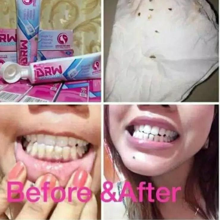 (Bci)✶Kem Đánh Răng Drwskincare Chất Lượng Cao U0100 | BigBuy360 - bigbuy360.vn