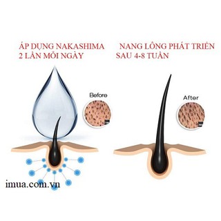 Thuốc thoa mọc râu hàng nhập Pháp