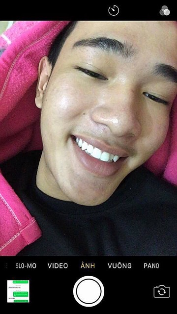 Gel Tẩy Trắng Răng Opalescence Hàng USA tuýp lẻ date 2026