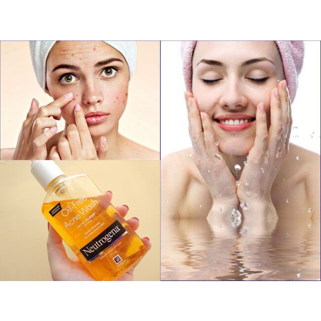 Sữa Rửa Mặt Cho Da Mụn Neutrogena Oil-free Acne Wash 269ml