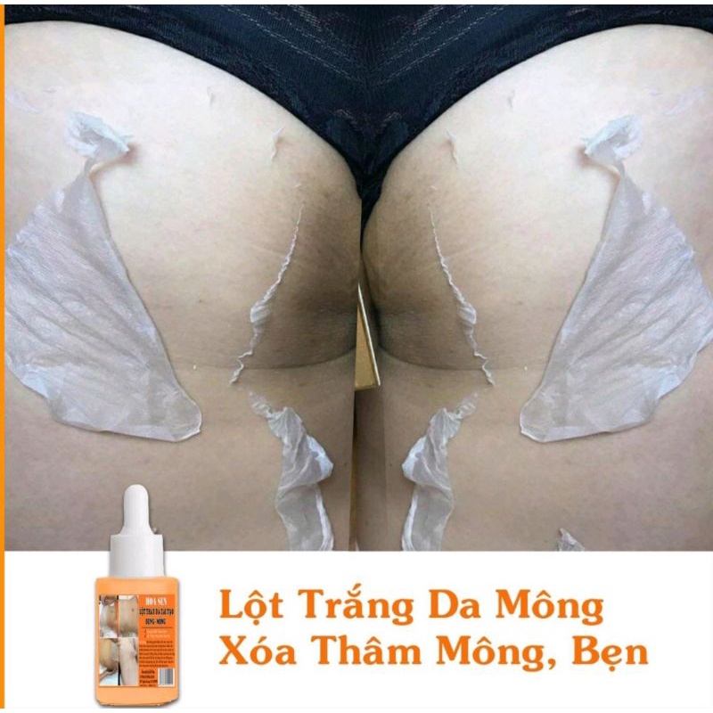 LỘT THAY DA MÔNG.HẾT THẰM MỜ RẠN.NỨT DA