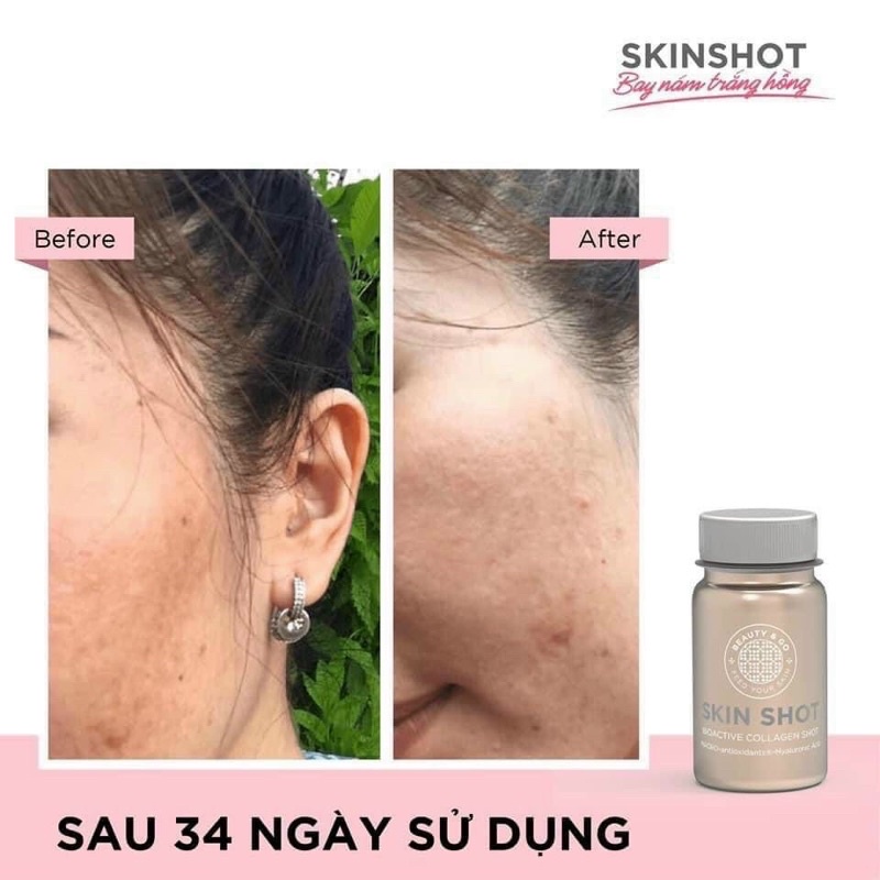 Nước uống collagen skin shot trắng da, giảm lão hoá, mờ thâm nám Skinshot Tây Ban Nha