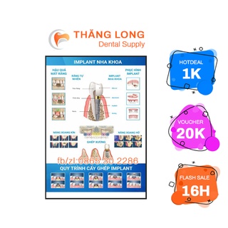 TRANH TƯ VẤN NHA KHOA CHỦ ĐỀ '' IMPLANT NHA KHOA''( IN TRANH )