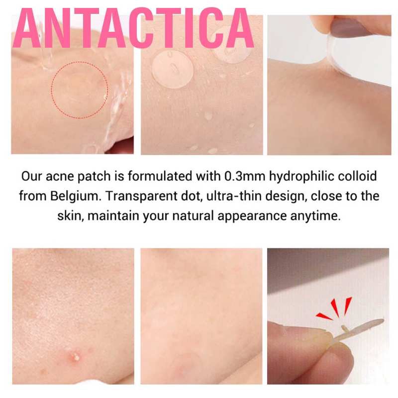 Set 36 Miếng Dán Che Mụn Chống Thấm Nước Thoáng Khí | BigBuy360 - bigbuy360.vn