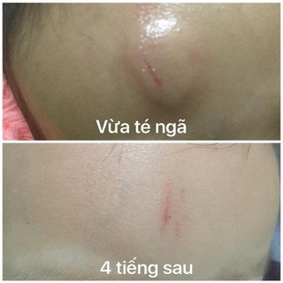 Combo Chăm Sóc Mẹ Và Bé Toàn Diện Sau Sinh