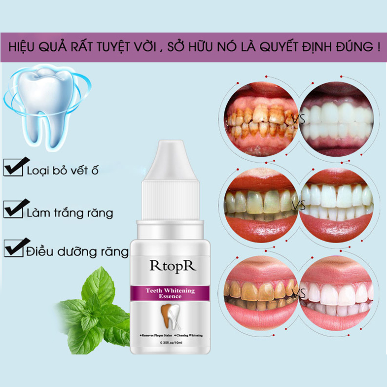 [Hàng Mới Về] Tinh Chất Trắng Răng RtopR  Làm Sạch Răng Teeth Cleaning