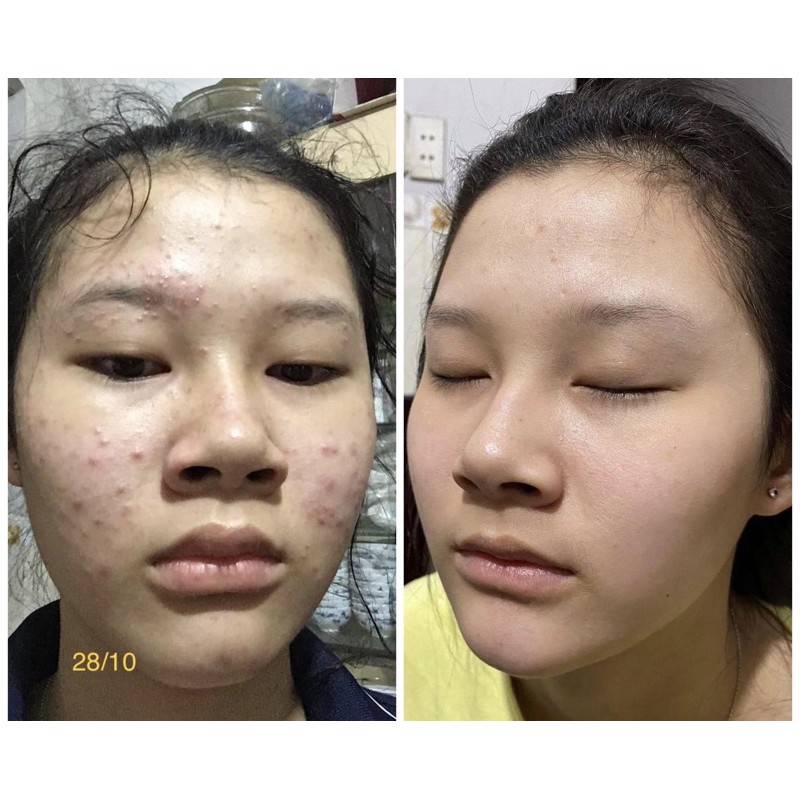 Serum Thảo Mộc OGANA