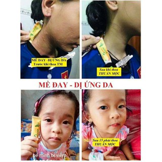 Kem bôi da Thuần khắc tinh của da Mộc
