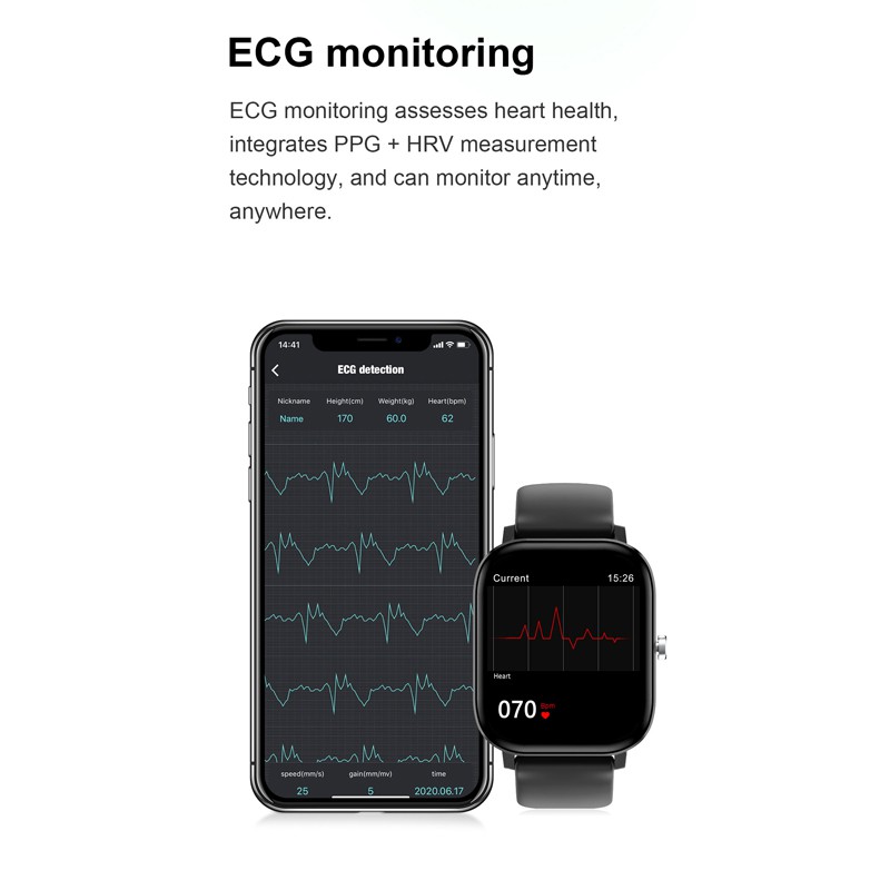 Đồng Hồ Thông Minh Cobrafly Dt36 Ecg 1.75 Inch Màn Hình Hd Cảm Ứng Đầy Đủ Có Bluetooth Không Thấm Nước Đo Nhịp Tim