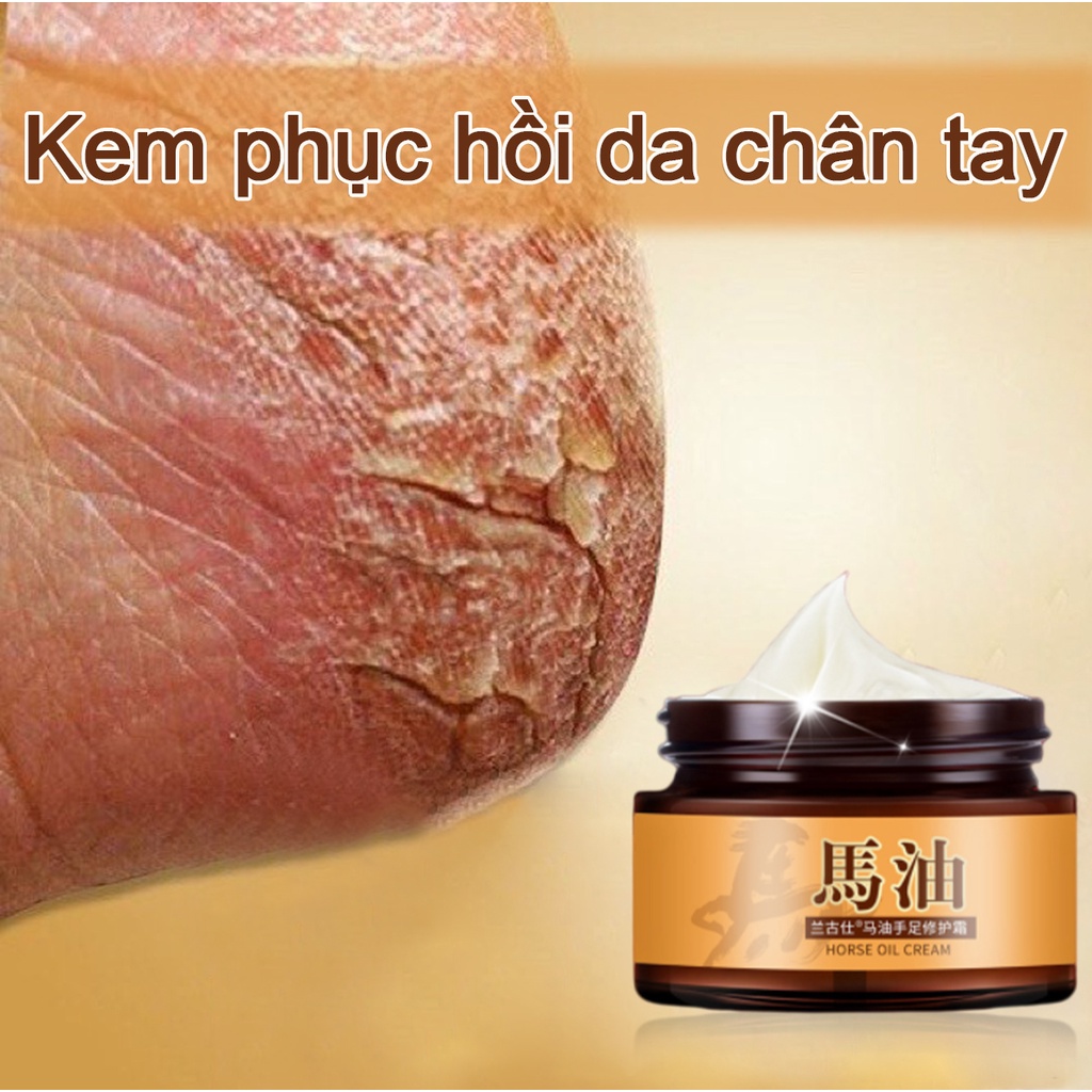 Phục hồi da nứt nẻ Cải thiện nếp nhăn Dưỡng ẩm sâu