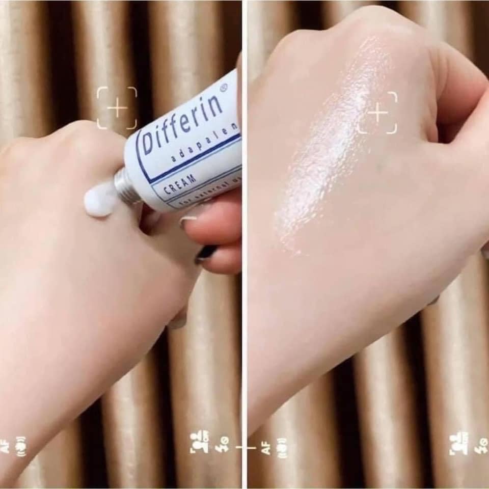 [CHÍNH HÃNG] Differin Cream giảm mụn ẩn, mụn trứng cá, mụn đầu đen cực tốt