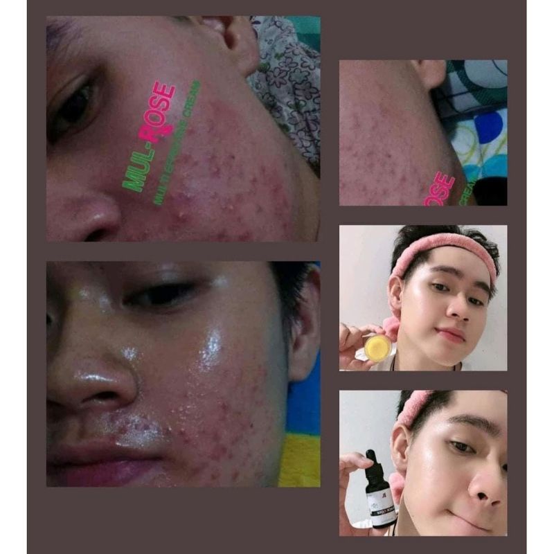 serum Black đẹp da