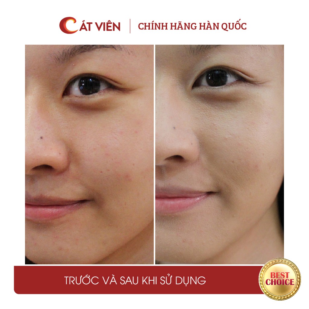 Tế bào gốc tái tạo da Plantex Medicell, chăm sóc da lăn kim, làm trắng da mờ thâm, se khít lỗ chân lông - lọ lẻ 5ml | BigBuy360 - bigbuy360.vn