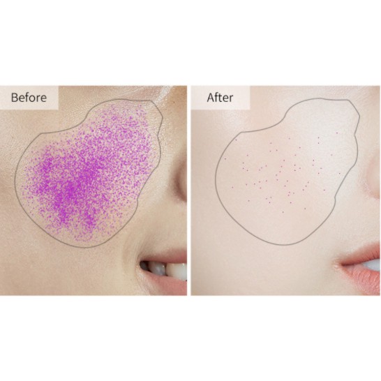 [SỈ ] Serum Heyxi Tinh Chất Se Lỗ Chân Lông   LYSHOP | BigBuy360 - bigbuy360.vn