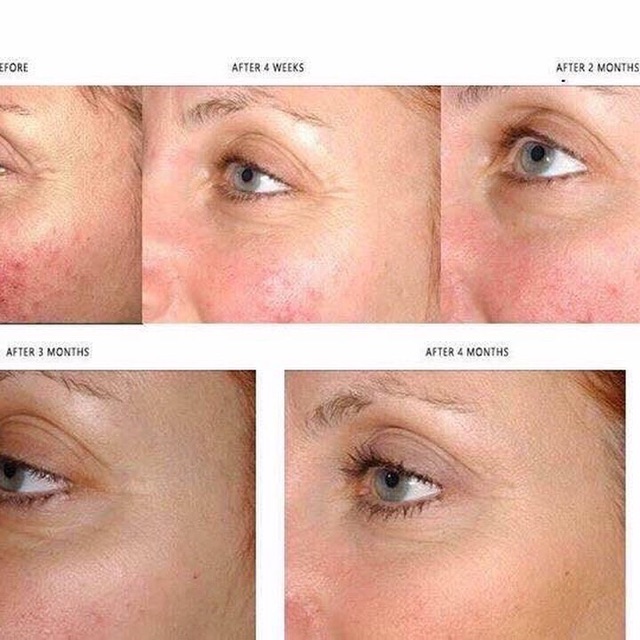 Kem dưỡng sáng da mờ nám Vento Pearl- Kem Vento Vàng,  Vento Vivere