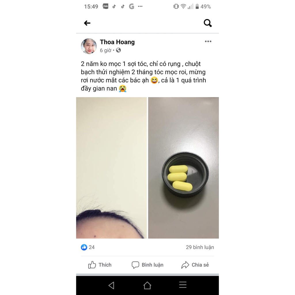 SupHerb Multi Hair Vitamin kích thích mọc tóc Do Thái